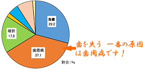 歯周病から守りましょう